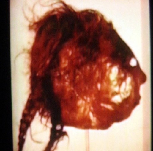 Na Foto: Máscara de pele humana confeccionada por Ed Gein do rosto de uma das vítimas. Créditos: Crime library