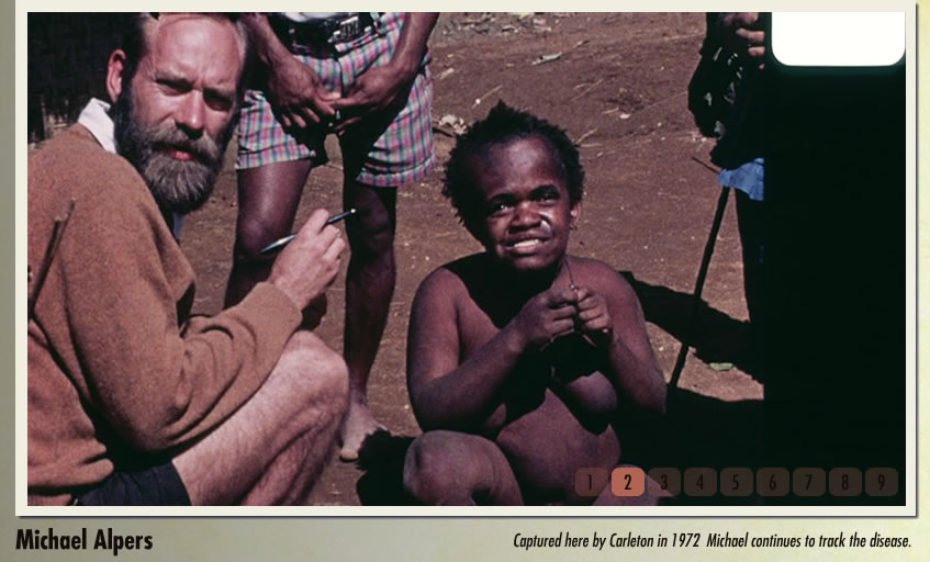  Michael Alpers, em 1972. Mais de 10 anos depois de chegar a Papua Nova Guiné, o médico continua rastreando a doença