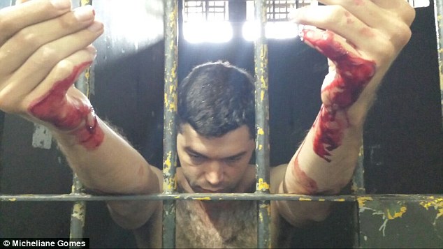 Na foto: Tiago da Rocha tentou o suicídio cortando os pulsos um dia após ser preso. Foto: Micheliane Gomes.