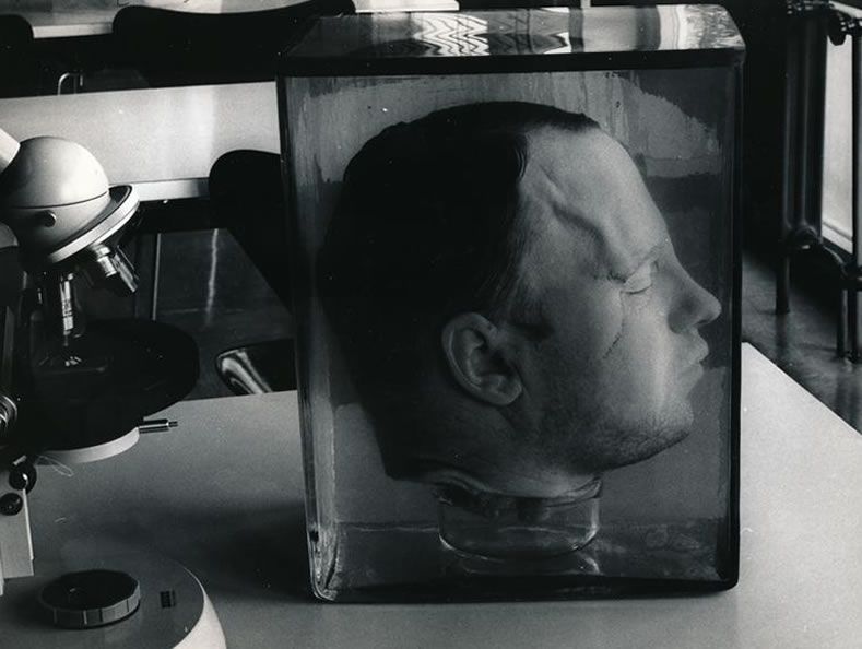 A cabeça de Fritz Haarmann. Foto: © dpa Archive.