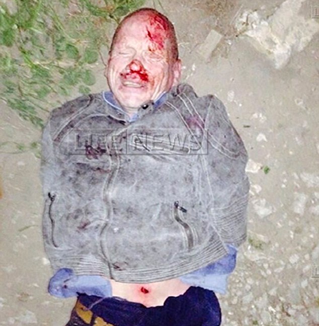 Semanas depois, sangrando e com cortes pelo corpo, Oleg Belov foi capturado pela polícia. Foto: Life News.