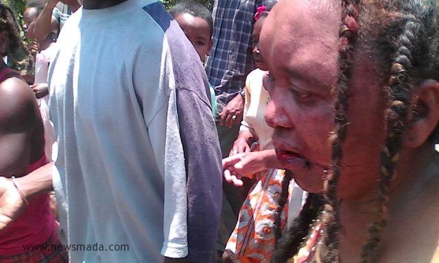 Mulher linchada em Madagascar em 30 de outubro. Foto: newsmada.com