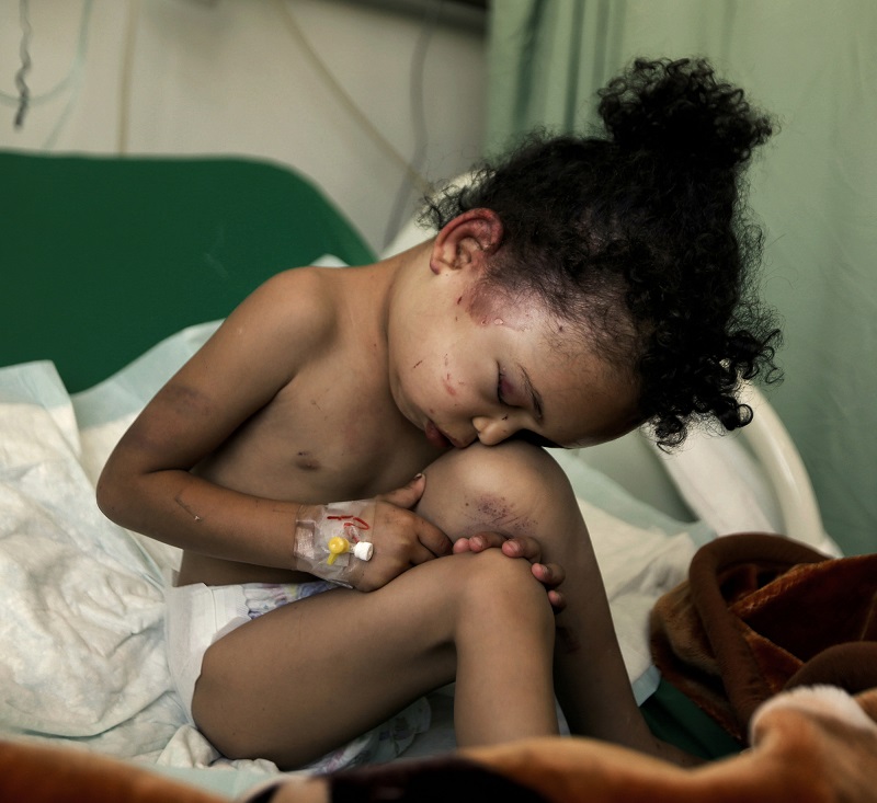 Esta é Buthaina Muhammad Mansour, uma criança de 4 ou 5 anos. Ela foi a única sobrevivente de um ataque aéreo da Arábia Saudita em 26 de agosto. O bombardeio matou 14 pessoas de sua família. Foto: Khaled Abdullah/Reuters.